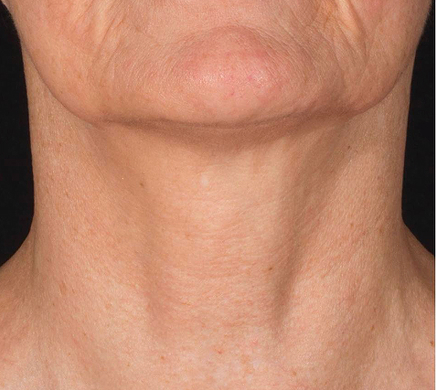 Placeholder Image (1)